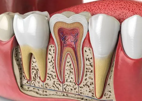 علاج قنوات عصب الأسنان