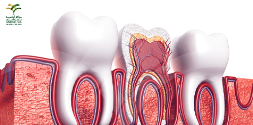 علاج قنوات عصب الأسنان