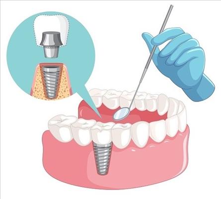 علاجات اللثة